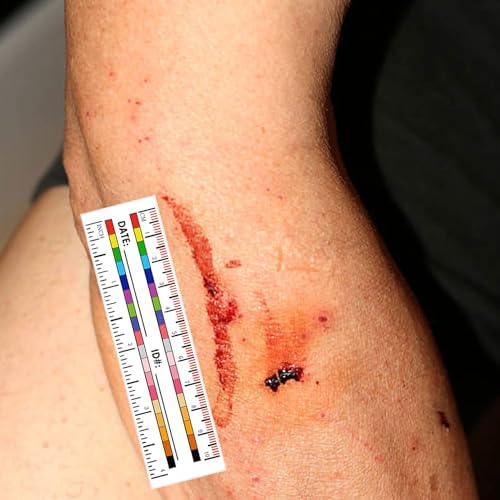 Self-Adhesive Wound Measurement Tools Sticker Wound Measuring Ruler Tape - Image 3