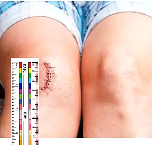 Self-Adhesive Wound Measurement Tools Sticker Wound Measuring Ruler Tape - Image 2